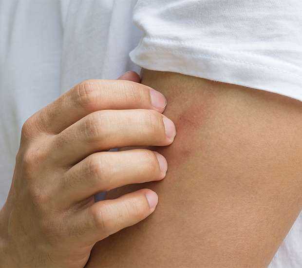 Reston Insect Bites and Stings Treatments